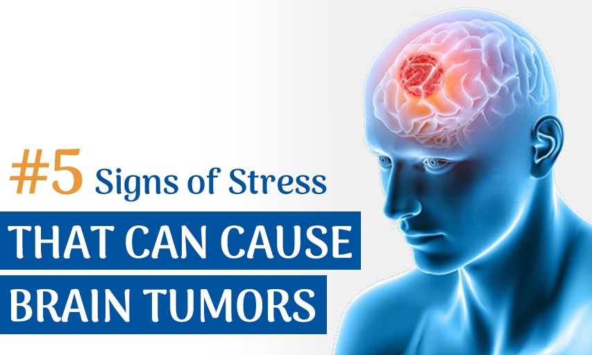 5 Signs of Stress That Can Cause Brain Tumors